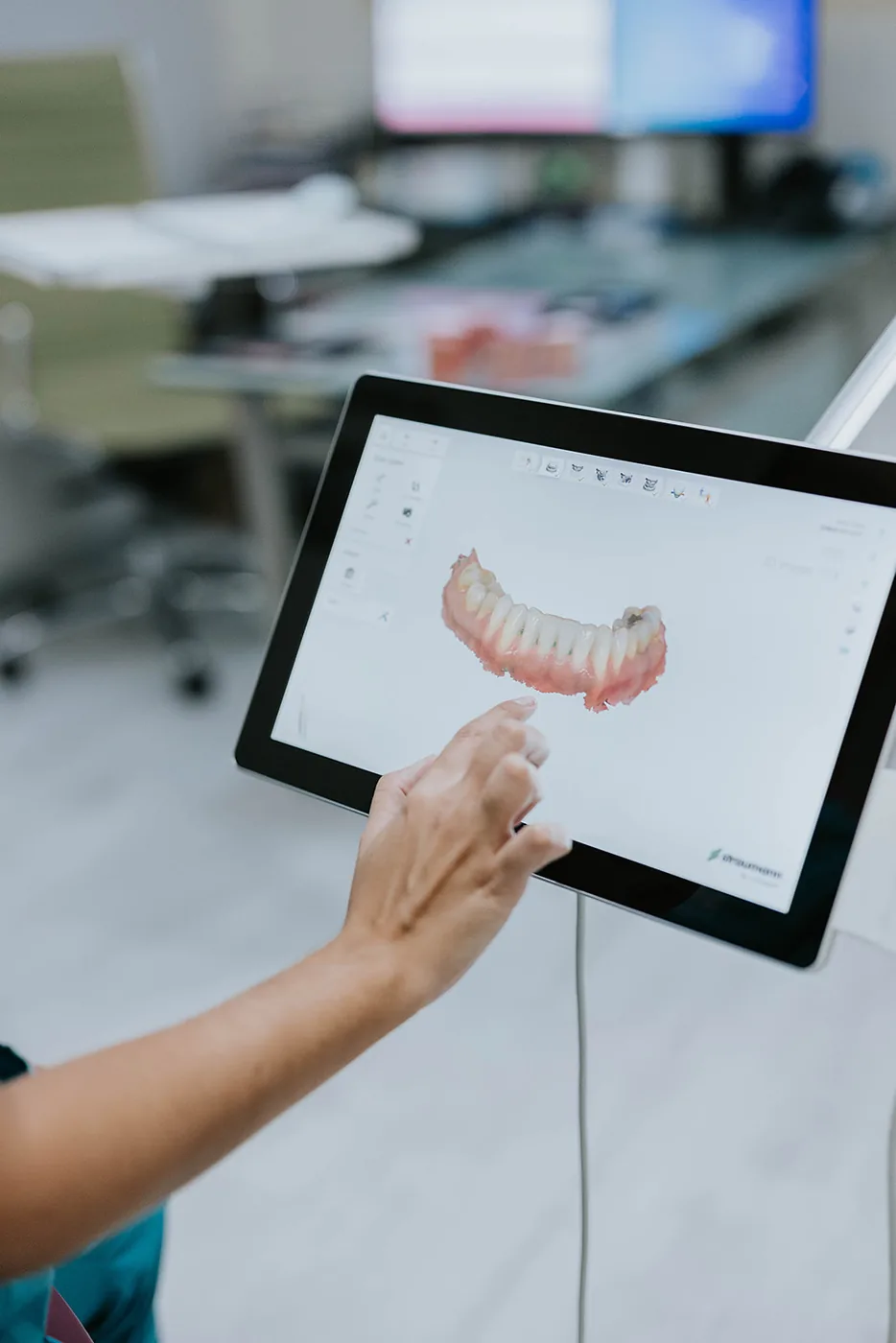 Diseño digital de sonrisa en iD estética dental